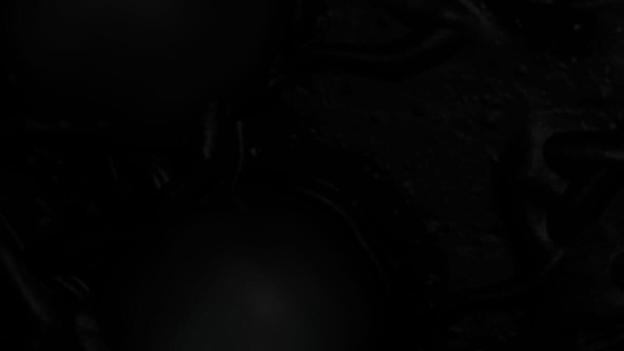 Anomalien